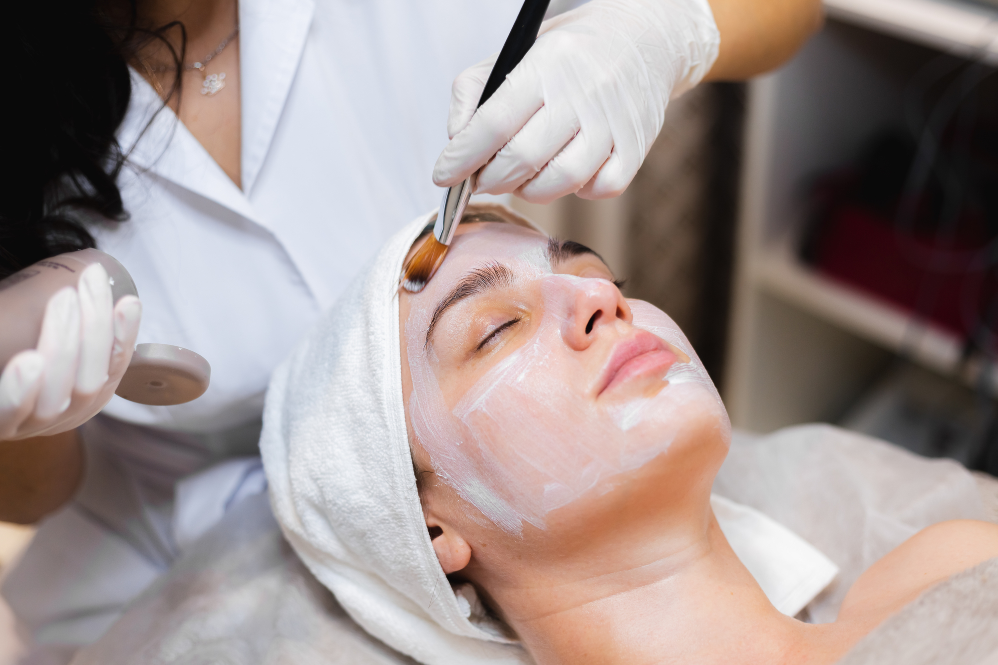Easy Chemical Peel For Dark Spots: Get Clear Skin Fast